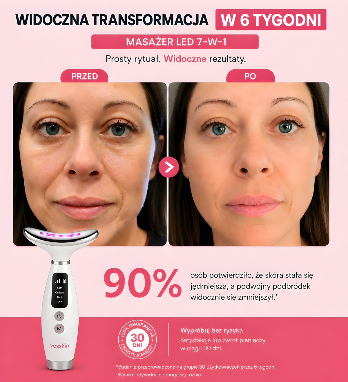 Vesskin™|Masażer do twarzy LED